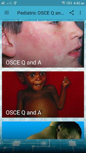 Pediatrics  OSCE Q and A screenshot 1