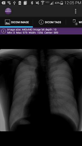 Mobile Dicom Viewer screenshot 4