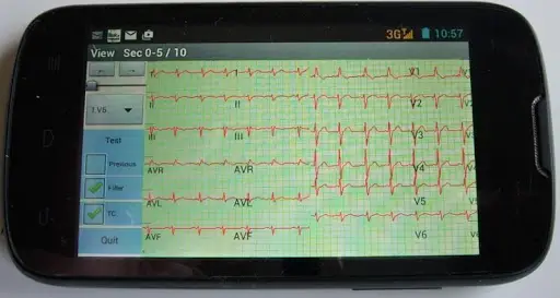 Mobile ecg recording screenshot 2