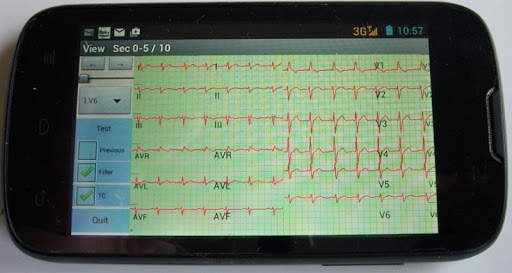 Mobile ecg recording screenshot 2