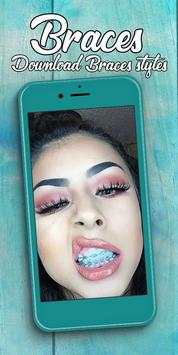 Braces screenshot 1