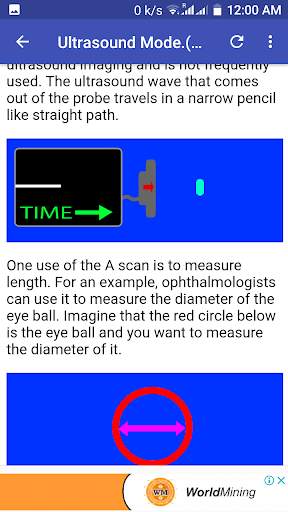 Ultrasound Guide A2Z screenshot 2