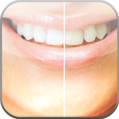 ikon Teeth Whitener Photo Edit Tips
