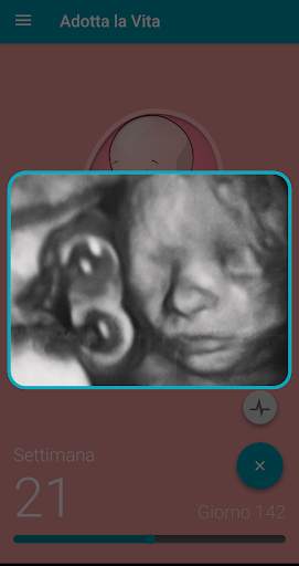 Adotta la Vita screenshot 3