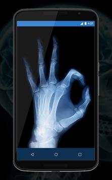 Xray Camera Scanner Prank screenshot 2