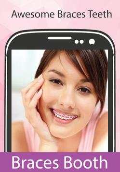 Brace Selfie Beauty Photo edit screenshot 1