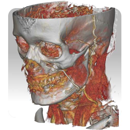 DroidRender - 3D DICOM viewer 3.9.3