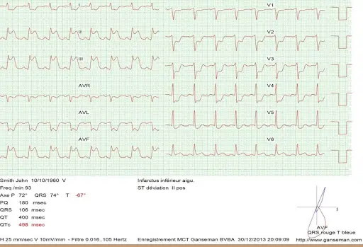 Mobile ecg recording screenshot 4