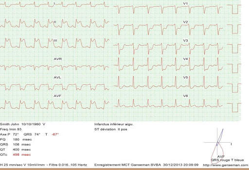 Mobile ecg recording screenshot 4