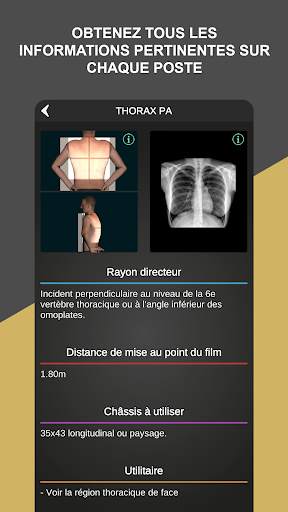 RX - Radiological Positions screenshot 4