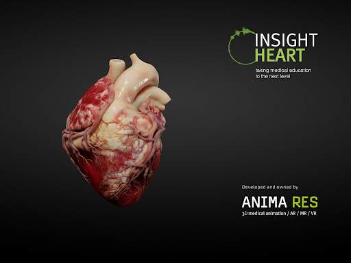 INSIGHT HEART Lite screenshot 11