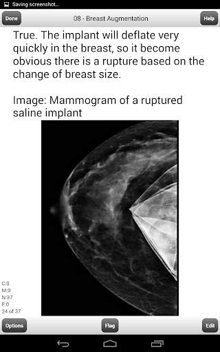 BREAST ULTRASOUND BOARDS FLASHCARDS LITE screenshot 10