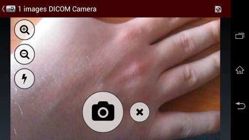 Dicompass DICOM Camera screenshot 7