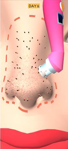 Nose Clean screenshot 5