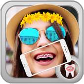 Braces stickers 3.2