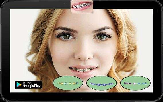 Real Braces Teeth Booth Pro screenshot 6