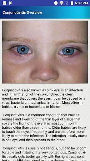 Help for Baby Conjunctivitis & Pinkeye in Children screenshot 1