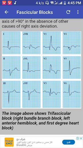 Clinical ECG Guide. screenshot 3