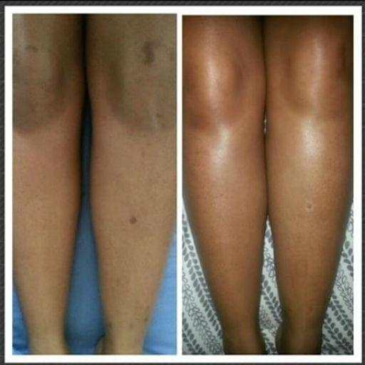 How to bleach your knee  (Guide) screenshot 2