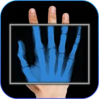 X-Ray Filter Photo on 9Apps