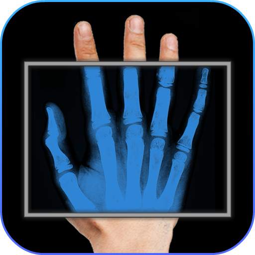 X-Ray Filter Photo 32