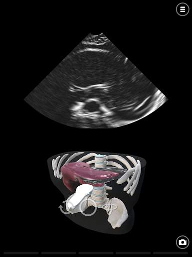 Deepscope Ultrasound Simulator screenshot 9