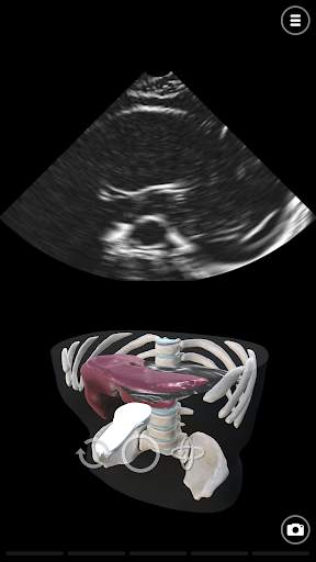 Deepscope Ultrasound Simulator screenshot 2