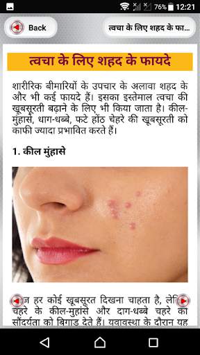 शहद के फायदे ~ shahad ke fayde~benefits of honey screenshot 6