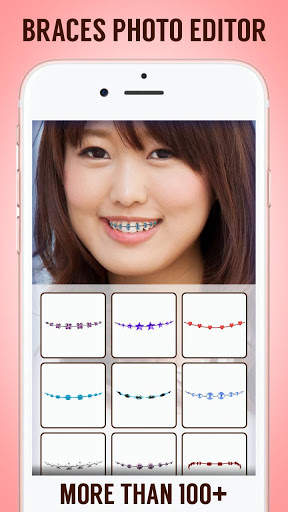 Braces 2.0 screenshot 4