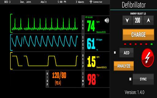 Beta PerSim™ Monitor screenshot 3