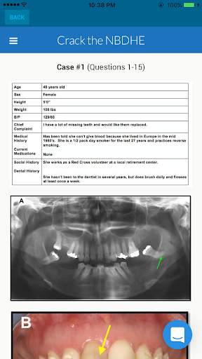 NBDHE - Dental Hygiene Prep screenshot 7