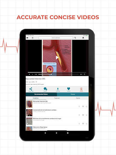 CardioVisual: Heart Health App screenshot 12