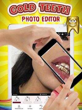 Gold Teeth Photo Editor screenshot 3