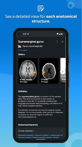 e-Anatomy screenshot 5