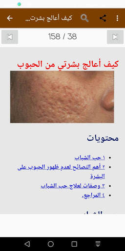 كيفية التخلص من حبوب البشرة screenshot 3