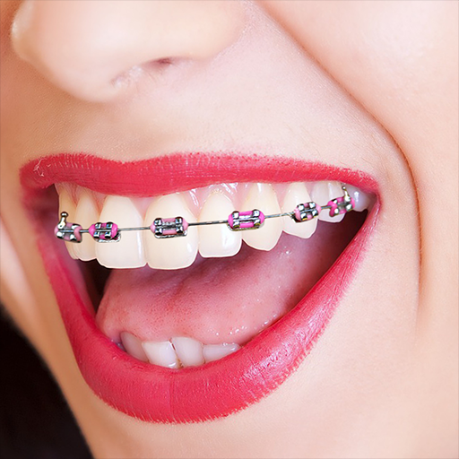 Braces Camera أيقونة