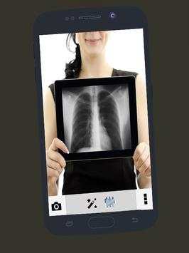 Sexy girls Xray scanner prank screenshot 2