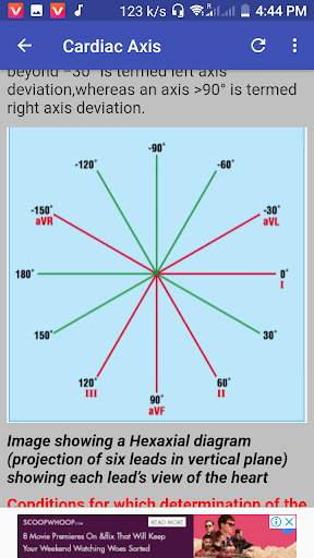 Clinical ECG Guide. screenshot 4
