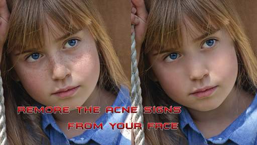 Pimples removing photo editing screenshot 1