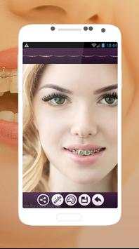 Braces Teeth Photo Editor screenshot 2