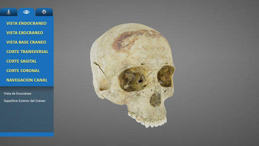 UC MedApp Craneo 3D screenshot 2