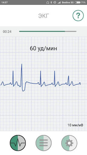 ECG mob скриншот 3