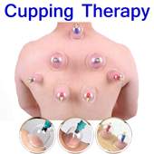 Cupping Therapy 1.0
