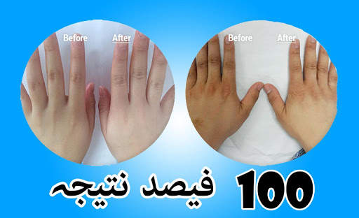Rang gora karne ki tips in urdu screenshot 2