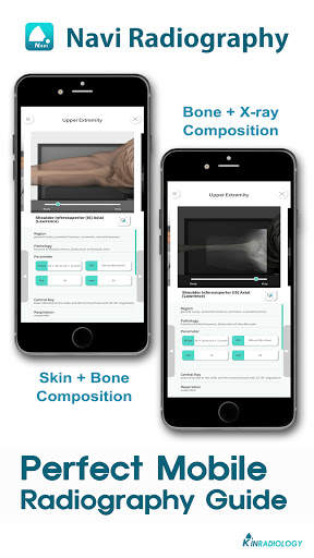 Navi Radiography Lite screenshot 3