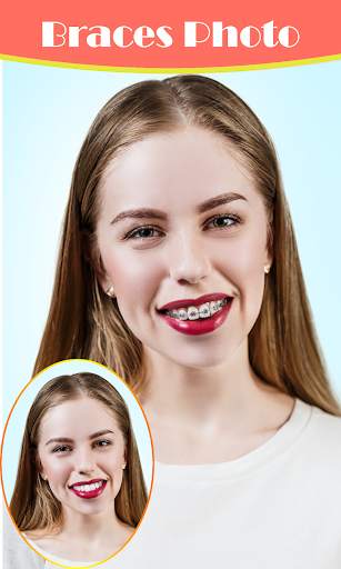 Braces Photo Editor 2021 screenshot 2