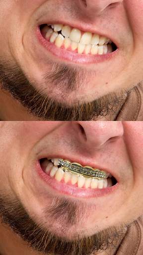 Gold Teeth Photo Editor screenshot 5