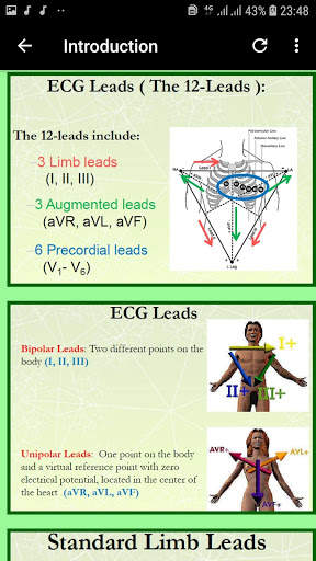 Clinical ECG Interpretation - GUIDE APP screenshot 7