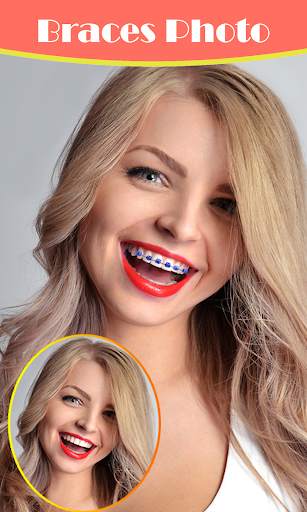 Braces Photo Editor 2021 screenshot 1