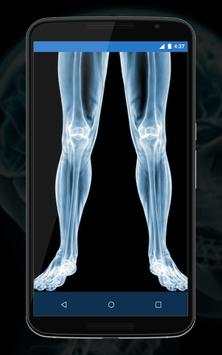 Xray Camera Scanner Prank screenshot 4